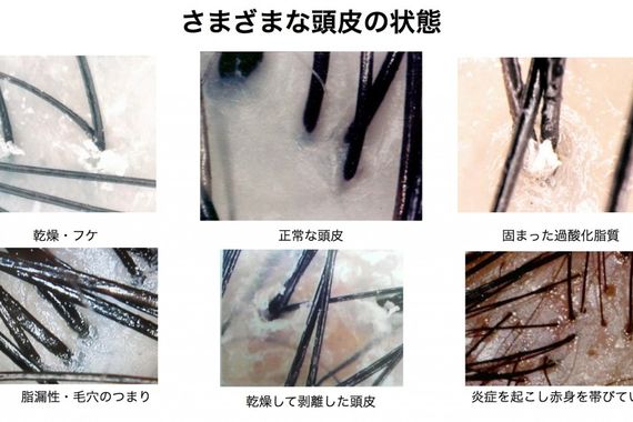 サンプル