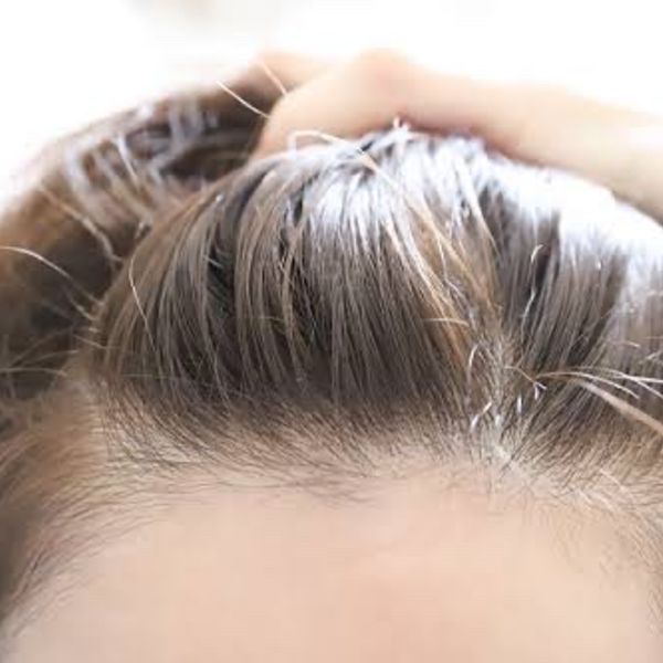 育毛、発毛に大切な３つの基本！