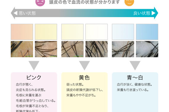 サンプル